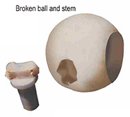 Broken ball and stem